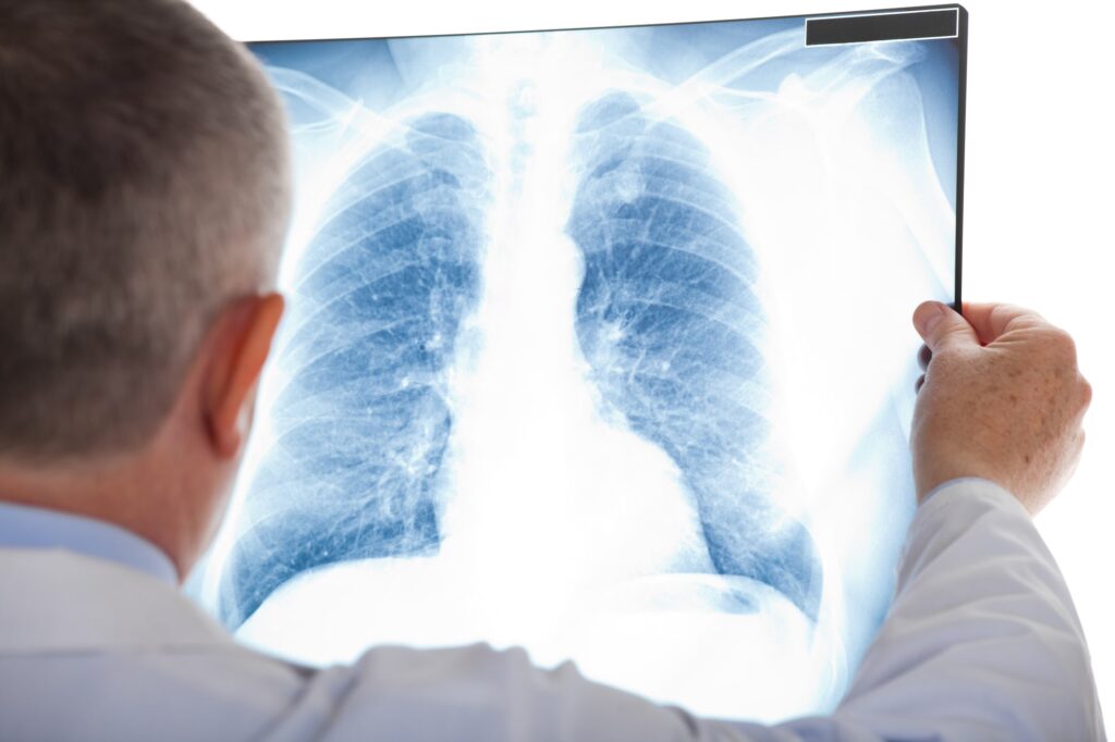 Ventura California Personal Injury Law Firm - Cohen Injury Law Group